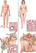 Differences of Sex Development