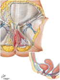 Perineum and External Genitalia: Female Superficial Dissection
