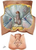 Perineum and External Genitalia: Male Superficial Dissection