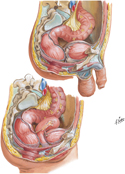 Rectum In Situ: Female and Male