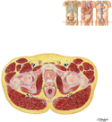 Male Pelvis: Cross Section of Bladder - Prostate Junction