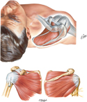 Rotator Cuff Muscles