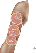 Arm: Serial Cross Sections