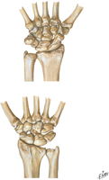 Carpal Bones