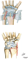 Ligaments of Wrist: Anterior View