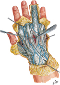 Wrist and Hand: Superficial Dorsal Dissection