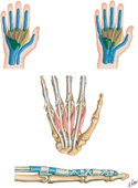 Hand: Lumbrical Muscles, Midpalmar and Thenar Spaces, and Tendon Sheaths
