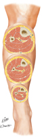 Leg: Serial Cross Sections