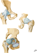 Hip Joint