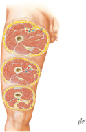 Thigh: Serial Cross Sections