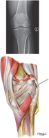 Knee: Anteroposterior Radiograph and Posterior View
